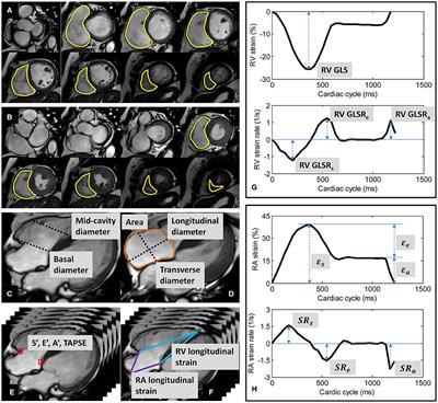 Frontiers Age And Sex Specific Changes In Cmr Feature Tracking Based